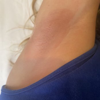Sugar Bella Skin and Sugar - Right after sugar scrub armpit - Sugaring Near Me - Seal Beach, California Sugar Bella Skin and Sugar - Right after sugar scrub armpit - Sugaring Near Me - Seal Beach, California