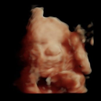 Unique Ultrasound Redlands - Ultrasound Imaging Centers Near Me - Redlands, California