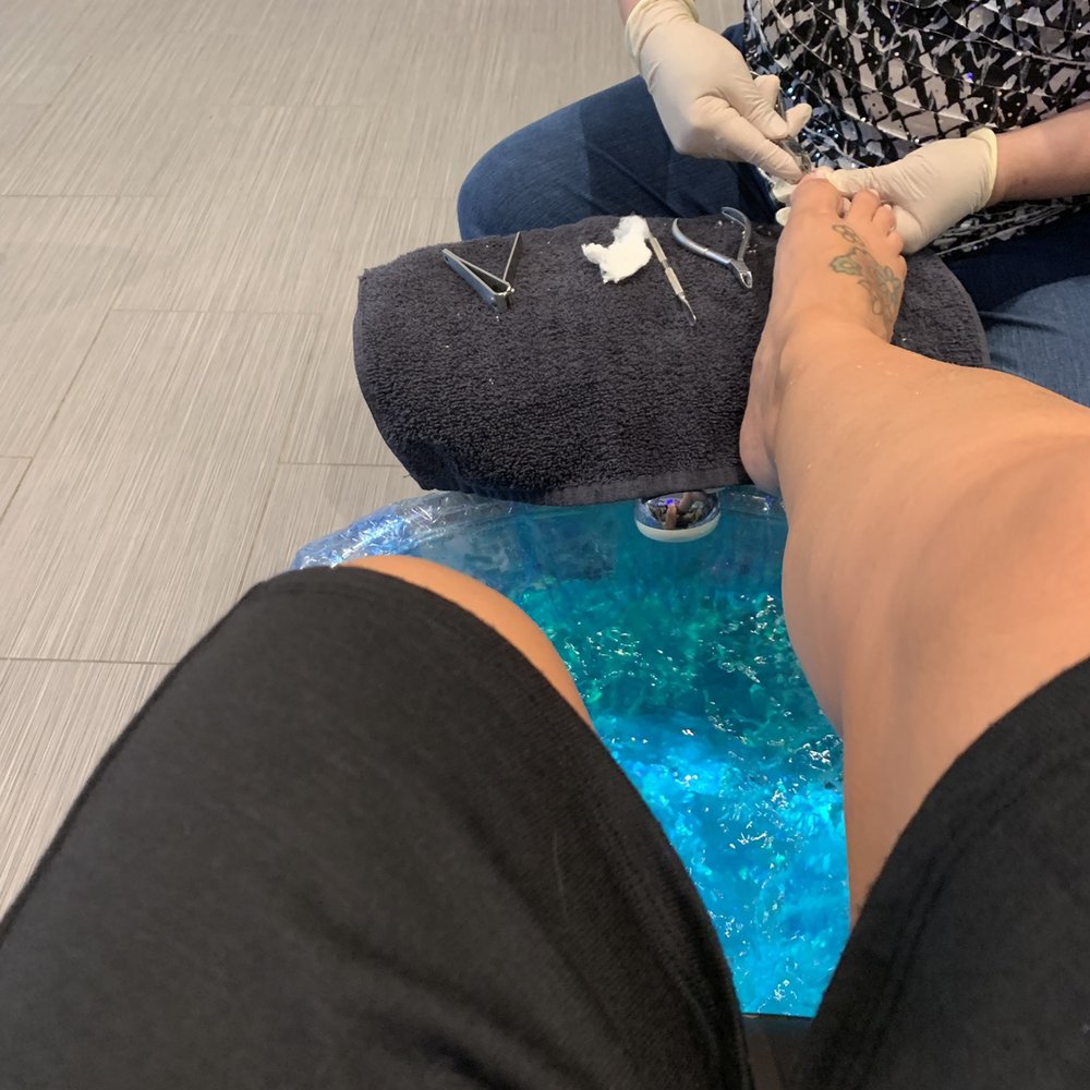 Venetien Nail - While bleeding. - Nail Salons Near Me - Riverview, Florida Venetien Nail - While bleeding. - Nail Salons Near Me - Riverview, Florida
