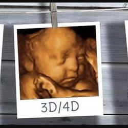 Hey Baby! 4D Ultrasound Studio - Ultrasound's available at Hey Baby! 4d