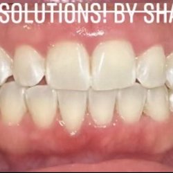 Smile Solutions by Shannon - After