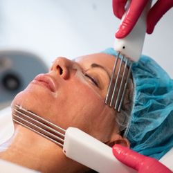Sacramento Medical Spa - Neurotris Microcurrent