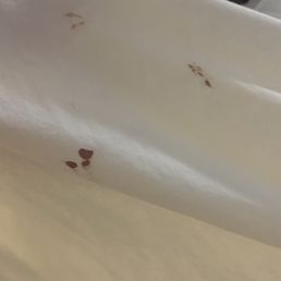 Blood on sheets Blood on sheets