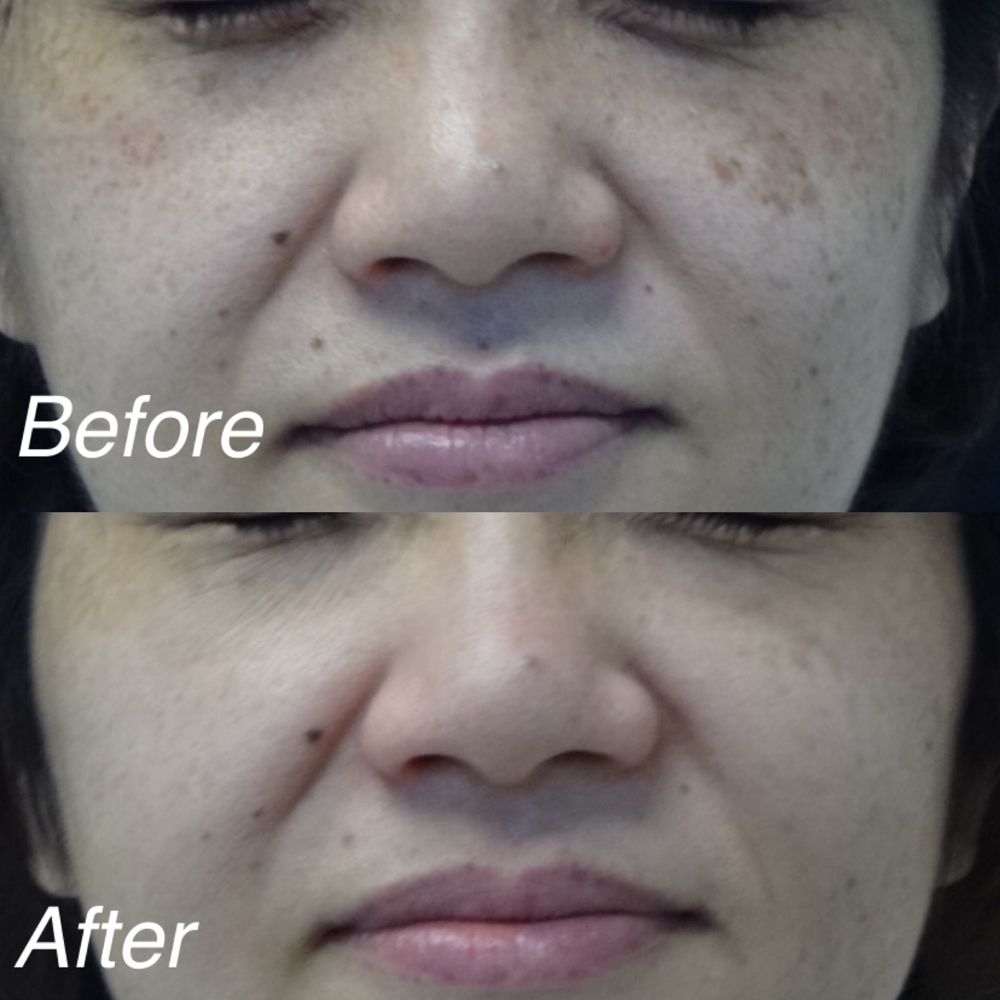 Imperial Facial Logo