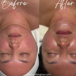 Afterglow Esthetics