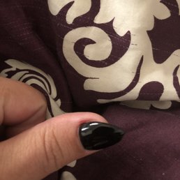 Redness and scab next to my thumbnail Redness and scab next to my thumbnail