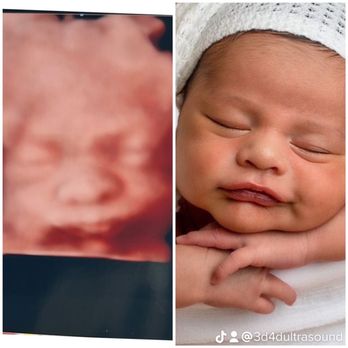 3D-4D Ultrasound Studio Queens - Diagnostic Imaging Near Me - Flushing, New York