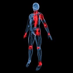 Progression Physical Therapy of Princeton - Joint pain or stiffness? Try Physical Therapy for some safe and appropriate mobility exercise!