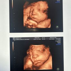 Prenatal Peek - Baby girl at 31 weeks!