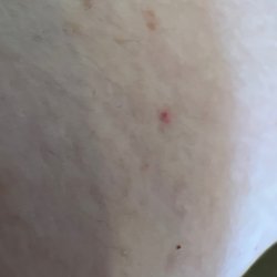 Labcorp - Just a little red dot the next day in the inside of the elbow!