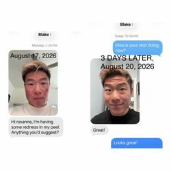 Esthetics by Roxanne - Blake has always struggled with acne. He told me his skin has never looked better. Yeah! Esthetics by Roxanne 415.655.9769