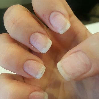 Sparks Nails & Spa - Before, after taking off acrylics. - Nail Salons Near Me - Denver, Colorado Sparks Nails & Spa - Before, after taking off acrylics. - Nail Salons Near Me - Denver, Colorado