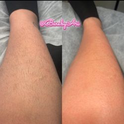 Leg wax before and after