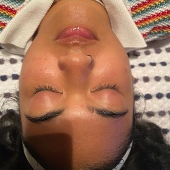 The Spa At Canyon Crest - After results of my facial! - Day Spas Near Me - Riverside, California The Spa At Canyon Crest - After results of my facial! - Day Spas Near Me - Riverside, California
