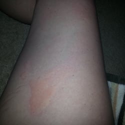 Kim's Nails - Burns
