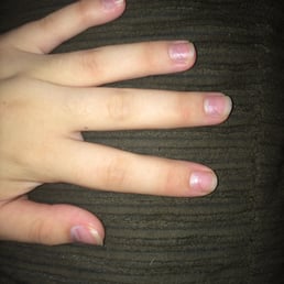 You can see the indents of where their acrylics were on my nails. Ruined my nail bed. Don't go here if you like your nail beds!!!!