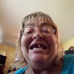 Dentures & Dental Services - Bad teeth