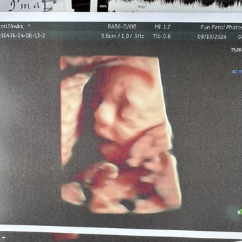 Fun Fetal Photos - Diagnostic Imaging Near Me - Hampton, Virginia Fun Fetal Photos - Diagnostic Imaging Near Me - Hampton, Virginia