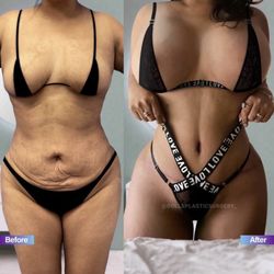 Dolls Plastic Surgery