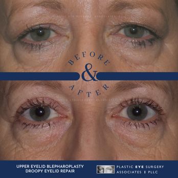 Plastic Eye Surgery Associates - Cosmetic Surgeons Near Me - Houston, Texas Plastic Eye Surgery Associates - Cosmetic Surgeons Near Me - Houston, Texas
