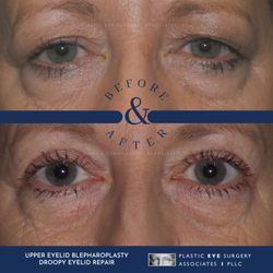 Plastic Eye Surgery Associates