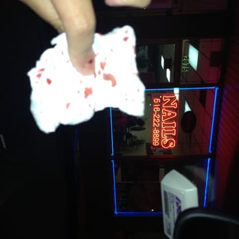 T One Nail & Spa - Today my experience at My Nail & Spa NY was horrifying. My skin was badly cut and my finger has been terribly bleeding. - Massage Near Me - East Meadow, New York T One Nail & Spa - Today my experience at My Nail & Spa NY was horrifying. My skin was badly cut and my finger has been terribly bleeding. - Massage Near Me - East Meadow, New York