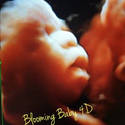 Blooming Baby 4D