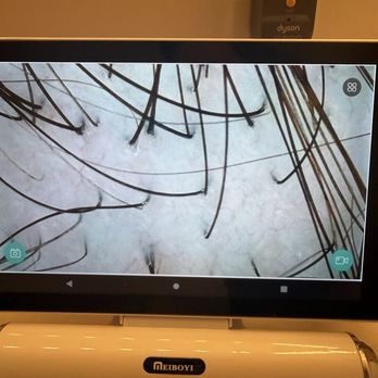 Anna’s Beauty Spa - Scalp after treatment - Eyelash Service Near Me - Clackamas , Oregon