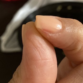 Lovely Nails & Spa - EXTREMELY SHAVED SKIN UNDERNEATH MY NAIL,you can clearly see the red Irritation...I'm still at a loss for words at how bad my "dip manicure" - Nail Salons Near Me - Montclair, California