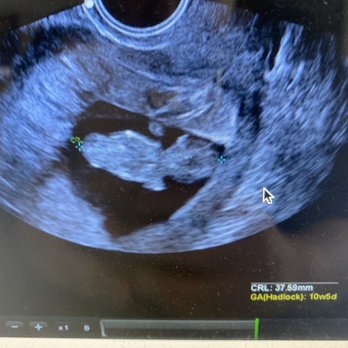 Care Fertility - My baby - Fertility Near Me - Glendale, California