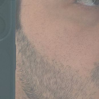 La'Vish Laser Center - Laser Hair Removal Near Me - Los Angeles, California