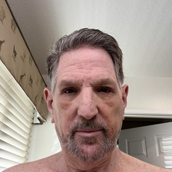 Daniel Ebroon, MD - Two weeks post surgery - Ophthalmologists Near Me - Thousand Oaks, California Daniel Ebroon, MD - Two weeks post surgery - Ophthalmologists Near Me - Thousand Oaks, California