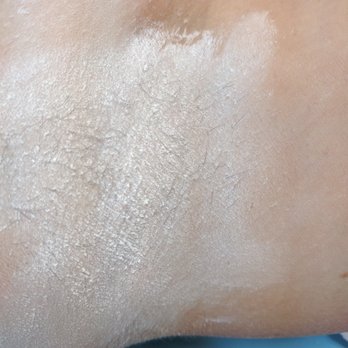 Mold Sugar - armpit sugaring - Sugaring Near Me - Santa Rosa, California