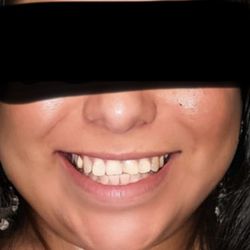Helotes Cosmetic & Family Dentistry