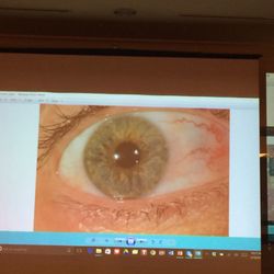 InSpiral Iridology - The iris of the gives you a blueprint of your physical and emotional health!