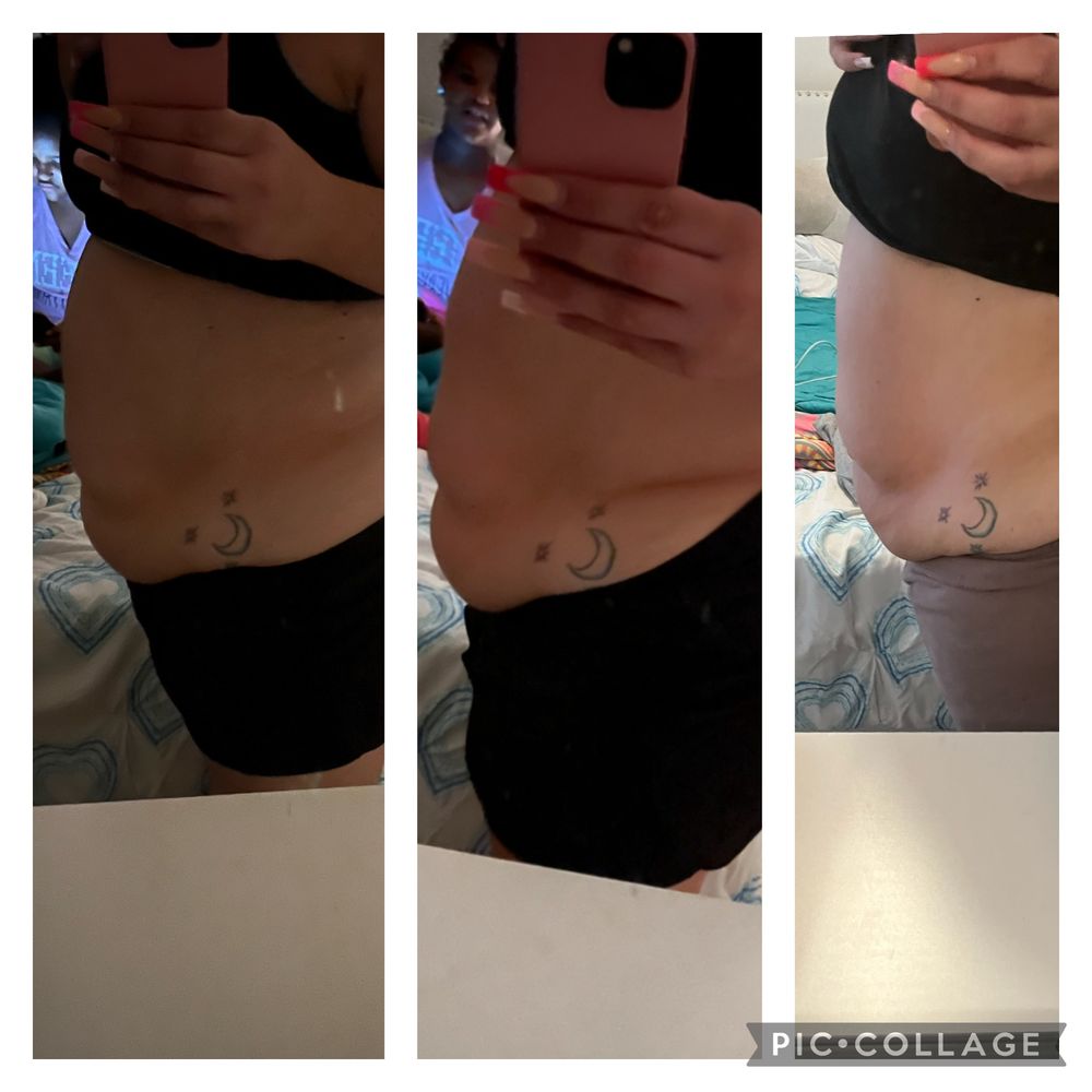 semaglutide injections north babylon Slim Shot Semaglutide Flex-Dose 2 mL Injectable