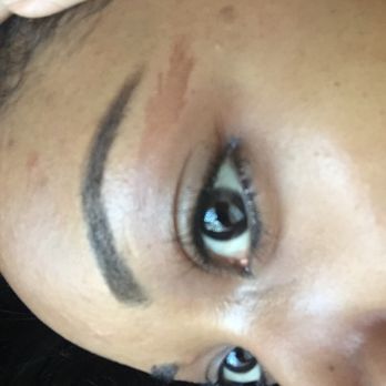 Paradise Nails - Eyelid is also swollen. - Nail Salons Near Me - La Mesa, California Paradise Nails - Eyelid is also swollen. - Nail Salons Near Me - La Mesa, California