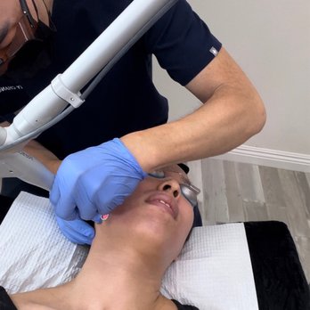 Eye Candy Vision and Beauty Clinic - Pico laser in process. - Medical Spas Near Me - Arcadia, California