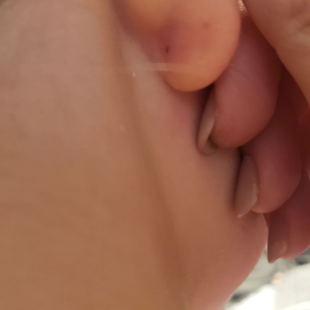 Brookside Tattoo - You see the healed hole on the right side and the new red hole on the left near her head. - Piercing Near Me - Tulsa, Oklahoma Brookside Tattoo - You see the healed hole on the right side and the new red hole on the left near her head. - Piercing Near Me - Tulsa, Oklahoma