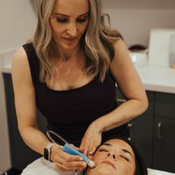 Inspired Beauty And Wellness - Microdermabrasion exfoliation