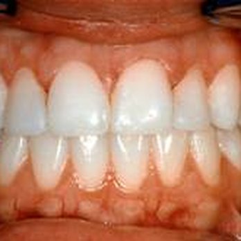 Young Dentistry - General Dentistry Near Me - Manahawkin, New Jersey Young Dentistry - General Dentistry Near Me - Manahawkin, New Jersey