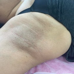 1222 Esthetic - Underarm wax