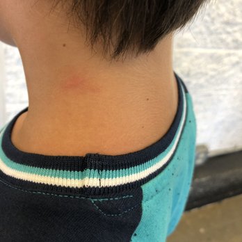 Journey Church - Red mark on his neck. - Churches Near Me - Pineville, Louisiana