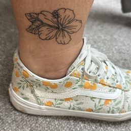 5 days after, not fully healed yet 5 days after, not fully healed yet