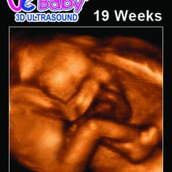 UC Baby - 3D Ultrasound