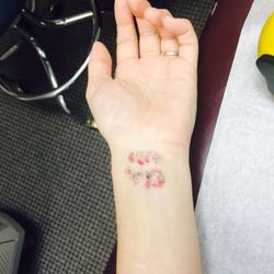 Laser Tattoo Removal by Whitney Broach