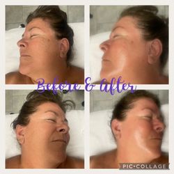 Luxe Skincare by Nicole - Dermaplane facial