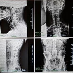 Lake Stevens Chiropractic