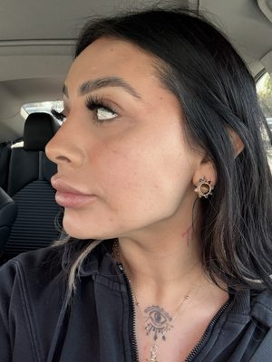 NAKEDMD - Updated December 2025 - 171 Photos & 79 Reviews - 1150 S