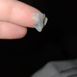 Something gross
